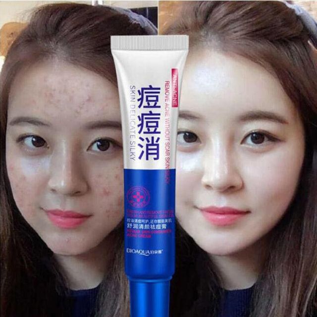 พร้อมส่ง-ครีมรักษาสิว-เจลรักษาสิว-ครีมแต้มสิว-ครีมลบสิว-ครีมรักษารอยสิว-acne-treatment-cream-anti-acne-scar