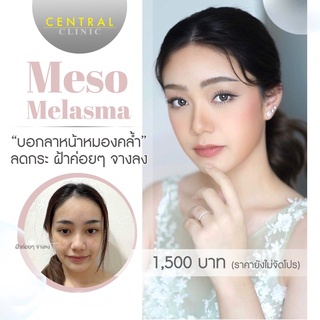 ภาพขนาดย่อของภาพหน้าปกสินค้าโปรแกรมผ่อนชำระ 25,000 บาท Installment Payment Voucher จากร้าน centralclinic_official บน Shopee