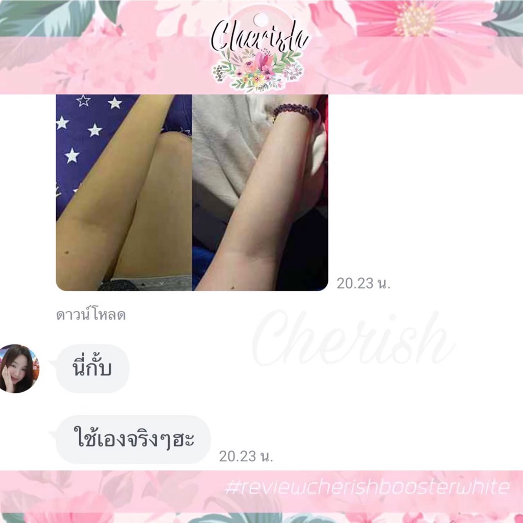 cherish-เพื่อผิวขาวกระจ่างใสและลดรอยแผลเป็น