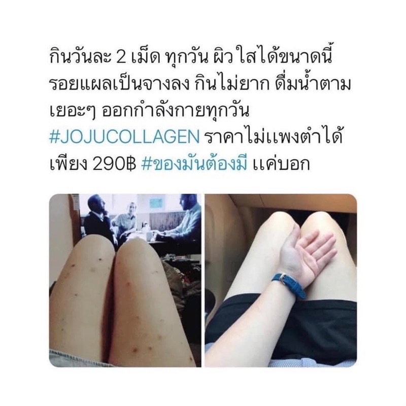 โจจู-ของแท้-ล็อตใหม่-คอลลาเจนโจจู-โจจูคอลลาเจน-joju-collagen-คอลลาเจน-โจจูแท้