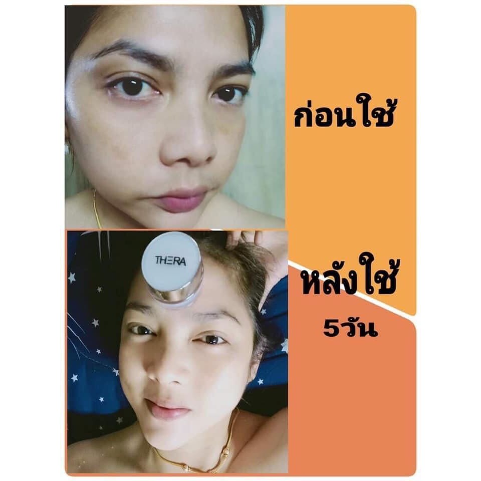 thera-เธอร่า-อินเทนซีฟ-ไวท์เทนนิ่ง-ครีมบำรุงผิวหน้า-สีครีมออร่าอมชมพู-ครีมเทอร่า-เทอร่า