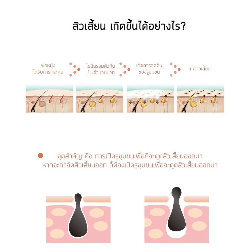 vanrro-เครื่องทำความสะอาดสิวเสี้ยนและกระชับรูขุมขน-ดูดสิวเสี้ยน-สิวอุดตัน-สิวหัวดำ-สิวหัวขาว