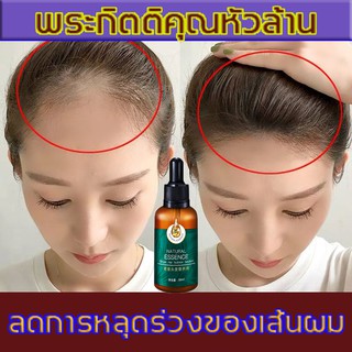 สินค้า น้ำยาบำรุงผมขิงแก่（ยาปลูกผม,บำรุงผม,เซรั่มปลูกผม,เซรั่มบำรุงผม,น้ำยาเร่งผมยาว,น้ำยาปลูกผม,น้ำยาใส่ผม, สเปรย์รากผมขิง）