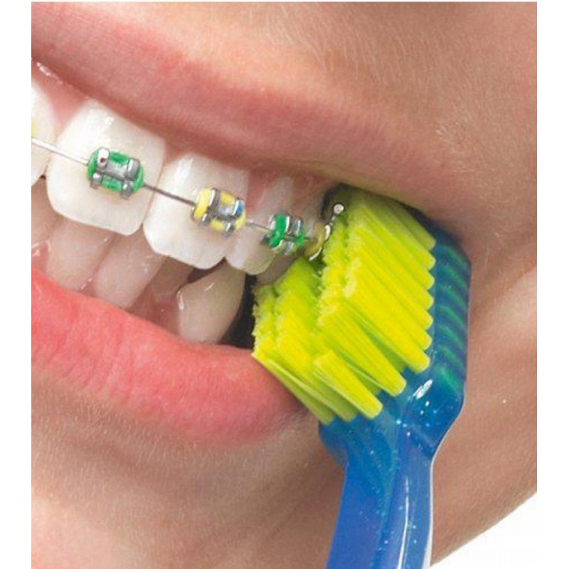 แปรงสีฟันสำหรับคนจัดฟัน-curaprox-cs-ortho-ด้ามสีชมพู