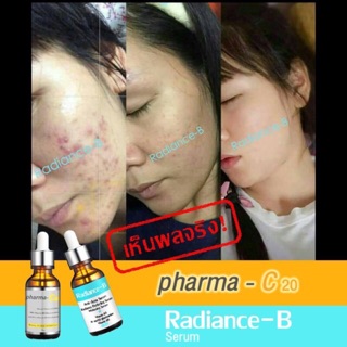 (ส่งฟรีEMS)(ใส่โค้ดลดเพิ่ม100฿)RadianceB เซรั่ม หมดปัญหา สิว รอยสิว กระชับรูขุมขน ลดหน้ามัน