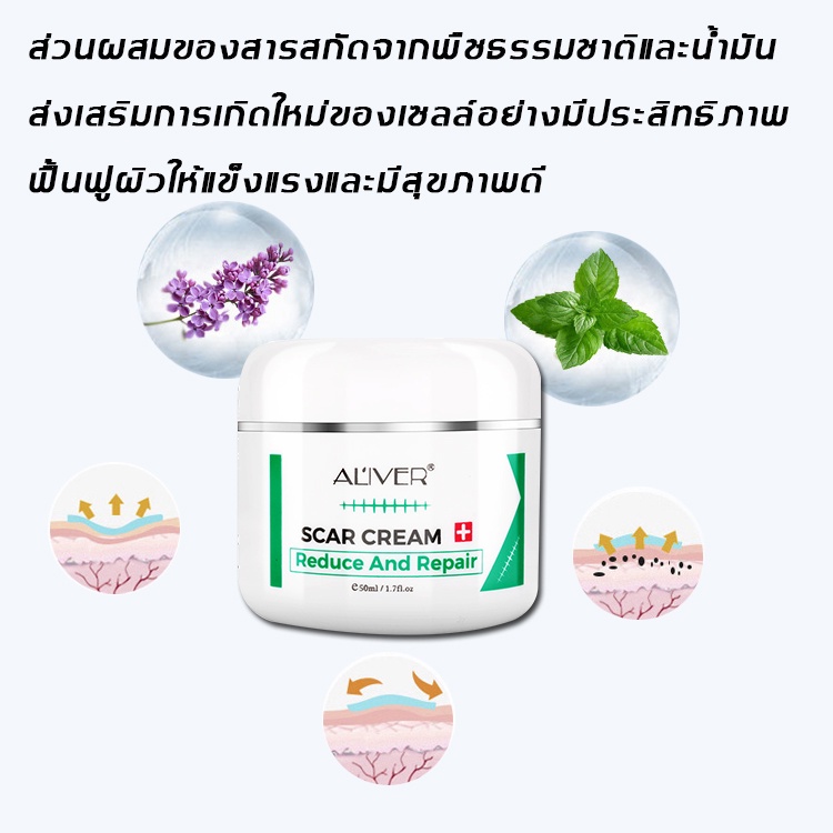 มีสินค้าพร้อมจัดส่ง-aliver-50ml-ครีมลดรอยแผลเป็น-ลบรอยครีมแผลเป็น-ครีมรักษาแผลเป็น-ยาทาแผลเป็น-ลดรอยแผลเป็น