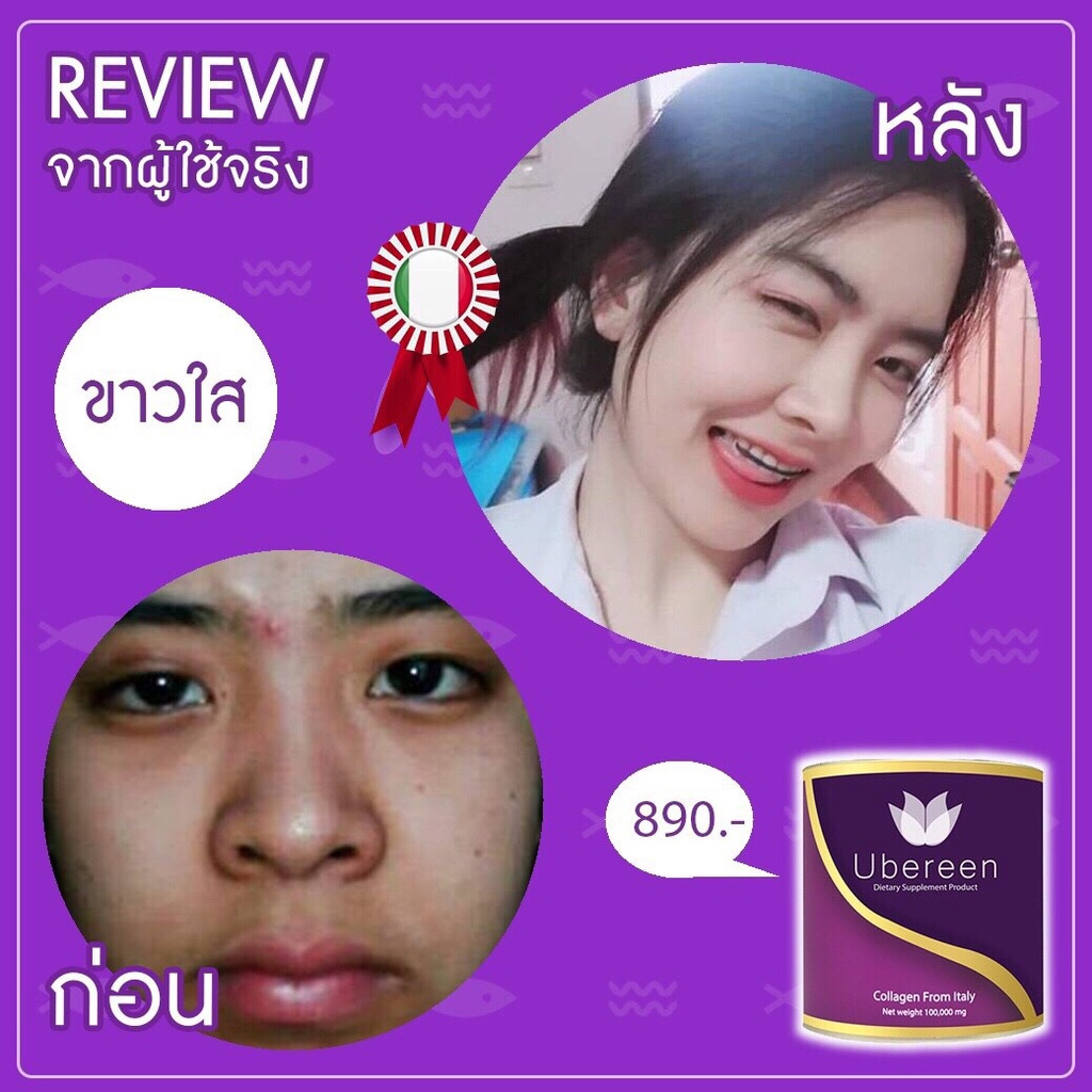 ubereencollagen2-acerola2คอลลาเจนที่มีวิตามินซีกลูต้าคอลลาเจนเกรดpremuimตัวช่วยผิวสวยที่ดีที่สุด-ร้านของบริษัทโดยตรง