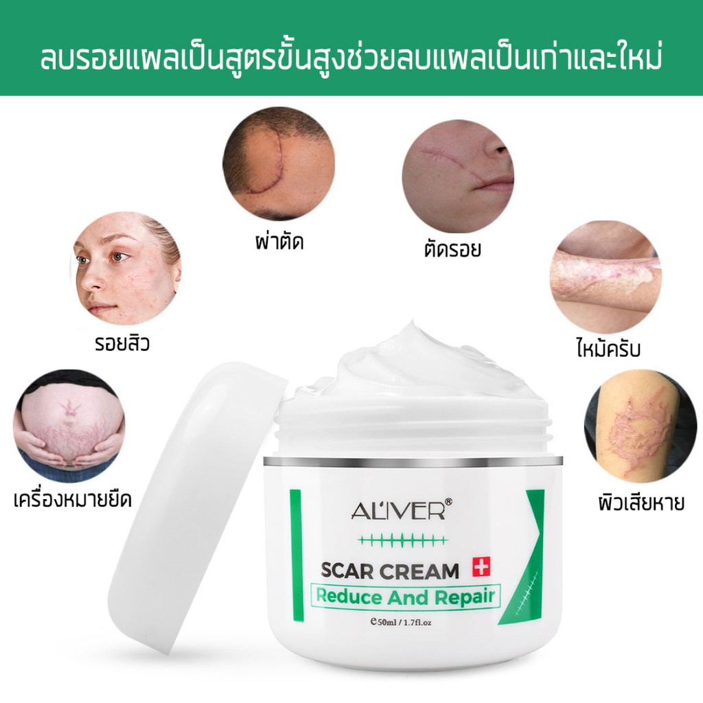 aliver-50ml-ครีมกำจัดรอยแผลเป็น-เจลลดรอยแผลเป็น-ครีมกำจัดรอยแผลเป็น-ครีมลดรอยแผลเป็น-ครีมลบรอยแผลเป็น-ครีมลดแผลเป็น