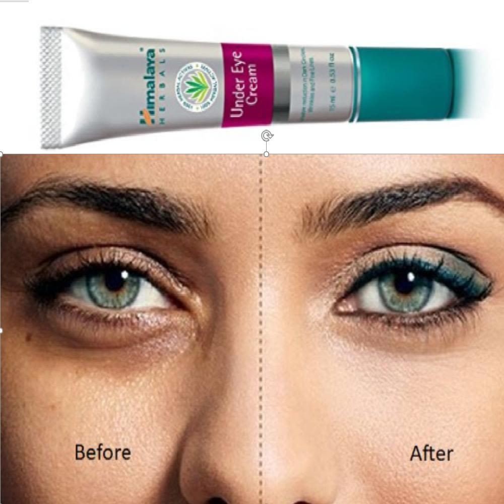 himalaya-under-eye-cream-15ml-หิมาลายา-อันเดอร์อายครีม-ครีมทารอบดวงตา-แก้รอบดวงตาหมองคล้ำ