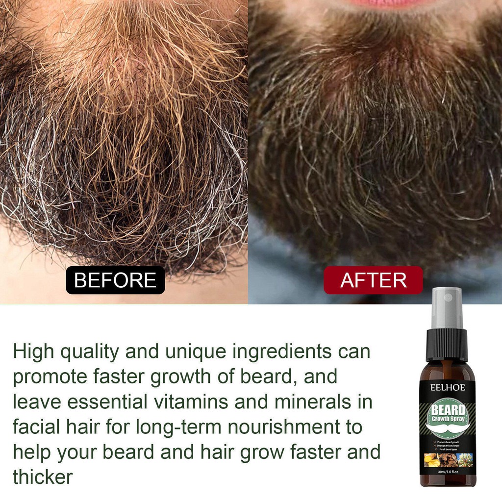 beard-เซรั่มปลูกหนวด-30ml-ปลูกผมปลูกหนวดปลูกคิ้วยาปลูกผมยาปลูกหนวดยาปลูกคิ้วเซรั่มปลูกผมเซรั่มปลูกหนวด-เซรั่มปลูกคิ้ว