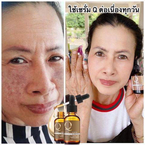 ขายดีอันดับ-1-เซรั่มคิว-q-double-serum-เคลียร์ฝ้า-กระ-ริ้วรอย-ท้าหน้าเด็ก-ของเเท้-100