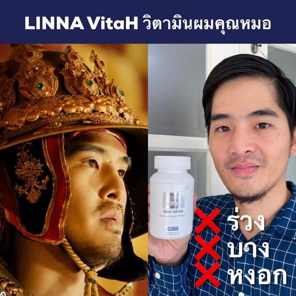 linna-vitah-วิตามินผมหางม้า-ลินนาแฮร์เซรั่ม-linna-hair-serum-แชมพู-shampoo