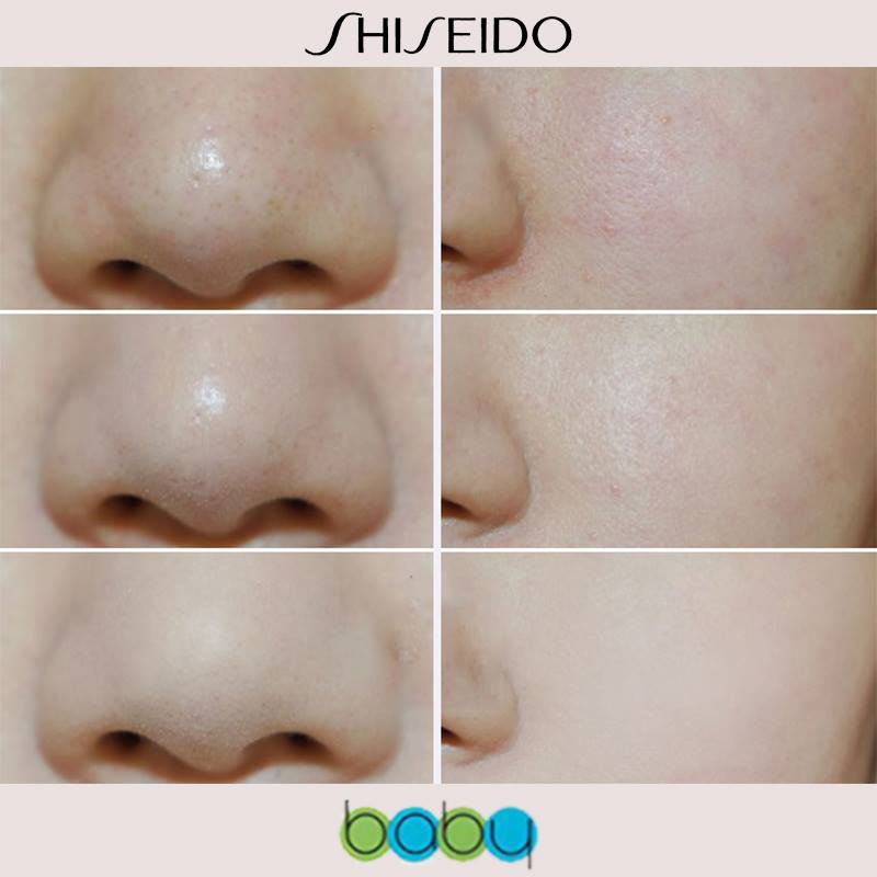 shiseido-baby-powder-pressed-medicate-แป้งฝุ่นอัดแข็ง-แป้งชิเชโด้-ของแท้100