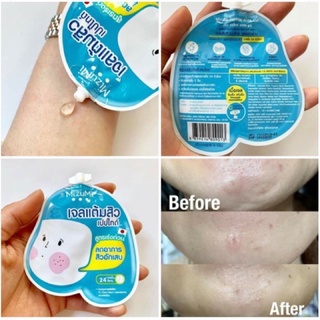 ภาพขนาดย่อของภาพหน้าปกสินค้าครีมซองเซเว่น MIZUMI Peptide Acne Gel มิซูมิ เจลแต้มสิว ซอง 4g*AA013 จากร้าน emmydesu บน Shopee ภาพที่ 1