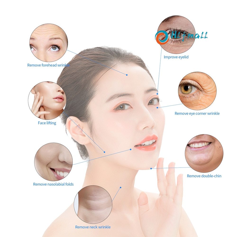 eye-bags-wrinkles-removal-5mhz-rf-facial-lifting-body-slimming-beauty-device-ips-photon-skin-rejuvenation-tightening-mac