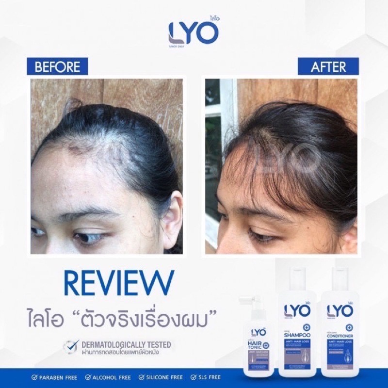 ภาพสินค้าส่งฟรี LYO ไลโอ หนุ่มกรรชัย  ไลโอแชมพู ไลโอแฮร์โทนิค lyo shampoo lyo hair tonic แชมพูแก้ผมร่วง จากร้าน chennnnn1 บน Shopee ภาพที่ 7