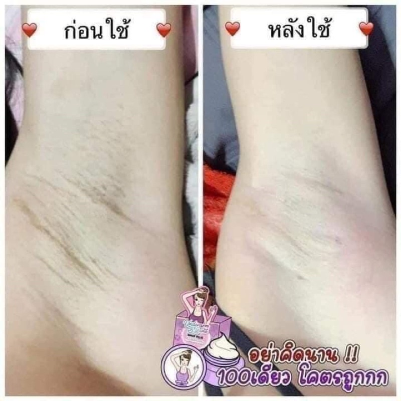 ครีมวิ้งพลัส-ครีมทารักแร้ขาว-ของแท้