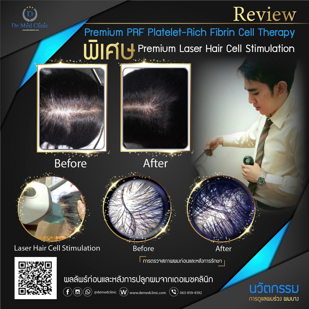 hairmax-regrow-md-laser-272-หมวกเลเซอร์-ราคาปกติ79-900บาทพิเศษ69-900-บาท-แถมพิเศษ-triple-h-treatment-1-ครั้ง-demed