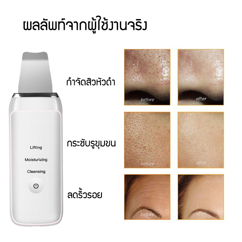 ha0008-ฟรีชุดกดสิว-เครื่องทำความสะอาดผิวหน้า-ultrasonic-เครื่องขัดผิวหน้าแบบพกพาอัลตราโซนิคใบหน้า-ยกกระชับใบหน้า