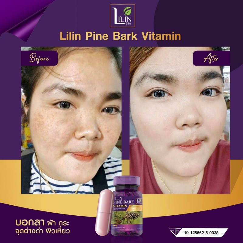 ภาพสินค้าLILIN Pine Bark Vitamin ผลิตภัณฑ์เสริมอาหาร ลิลิน ไพน์บาร์ค วิตามิน วิตามินผิว ลดฝ้ากระ ผิวหมองคล้ำ จากร้าน beautyclub14 บน Shopee ภาพที่ 5