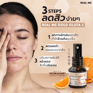 🚚วิตามินซี เรียลมี เซรั่มแก้สิว เซรั่ม Vit C สิวลด ยุบเร็ว รอยดำจากสิว สีผิวไม่สม่ำเสมอ ผิวเสียจากการติดสารแก้ได้