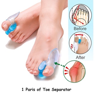 เครื่องมือซิลิโคนแยกนิ้วเท้า Hallux Valgus Hallux Bursitis ปะเก็นดูแลเท้า