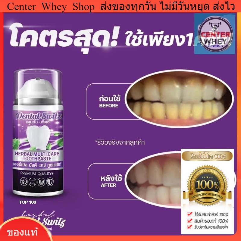 เจลฟอกฟันขาวdental-switz-เจลฟอกฟัน-ฟันขาว-ยาสีฟันขาว-1แถม-1