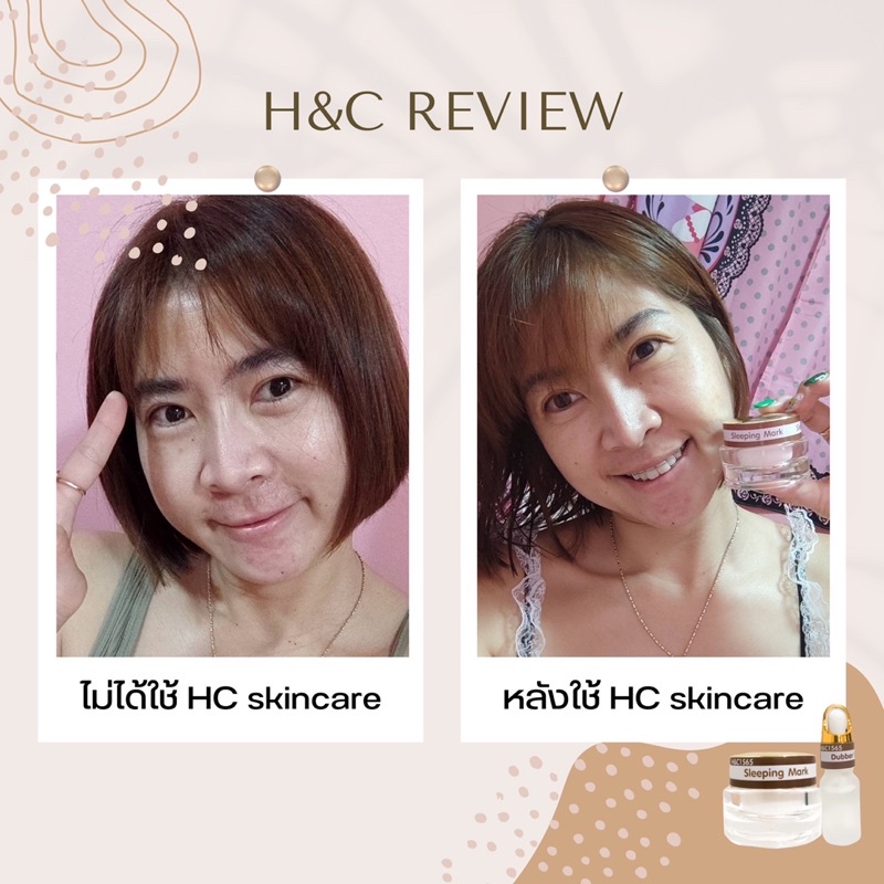 h-amp-c1565-sleeping-mask-amp-double-serum-รักษาสิวฝ้า