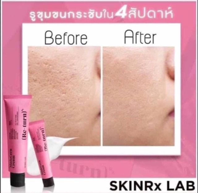 ครีมรีเทริน-return-ลดสิว-ลดฝ้า-ลดหลุม-กระชับรูขุมขน-ปรับหน้าขาวใส-พร้อมส่ง-15ml-ของแท้