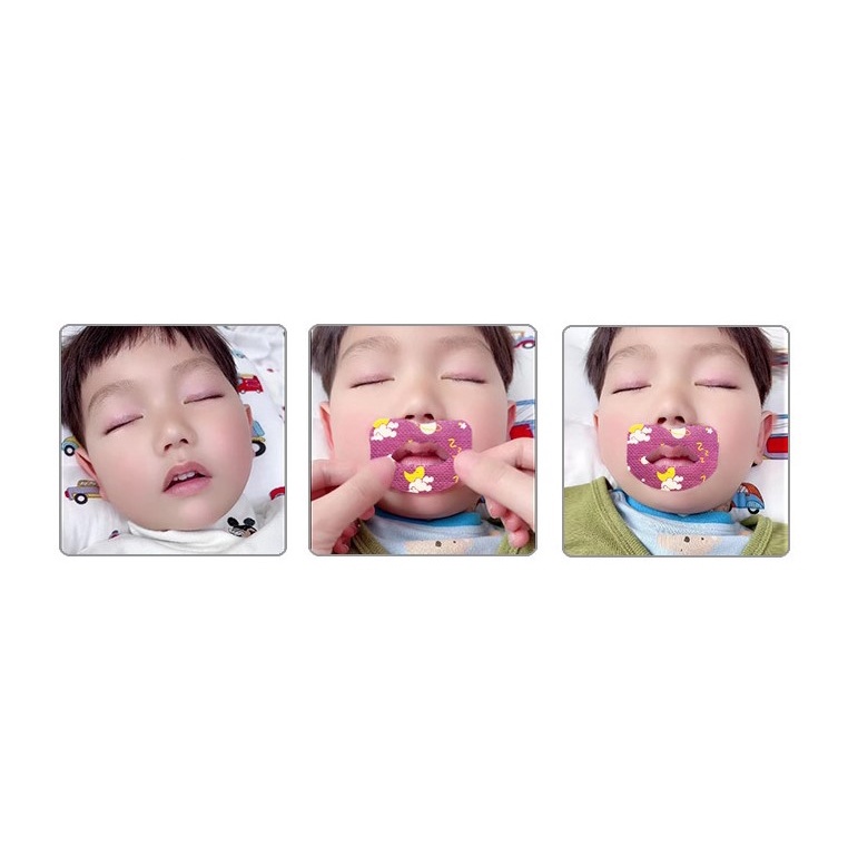 สติ๊กเกอร์แปะปาก-ab82-แผ่นแปะปากแก้การหายใจทางปากของเด็กขณะนอนหลับ