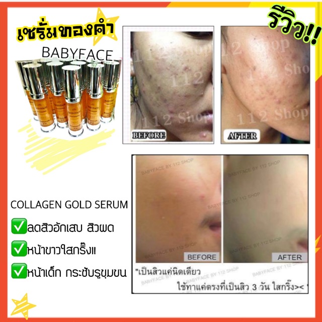 พร้อมส่ง-เซรั่มคอลลาเจนทองคำ-collagen-gold-serum-babyface-หน้าใส-หน้าเด็ก