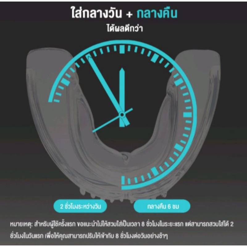 อุปกรณ์จัดฟันด้วยตัวเอง-จัดฟันแบบใส-จัดฟันที่บ้าน