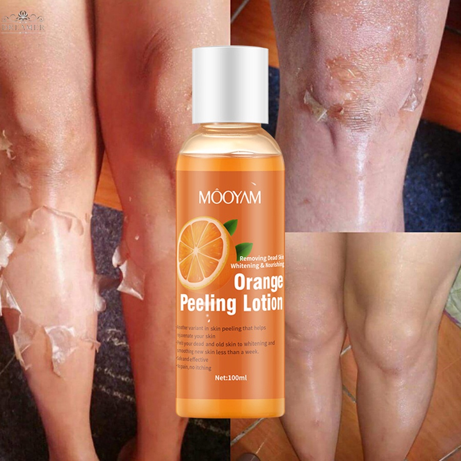 dreamer-foot-peeling-lotion-natural-orange-essence-pedicure-hands-dead-skin-exfoliator-mask-whitening-peeling-100ml