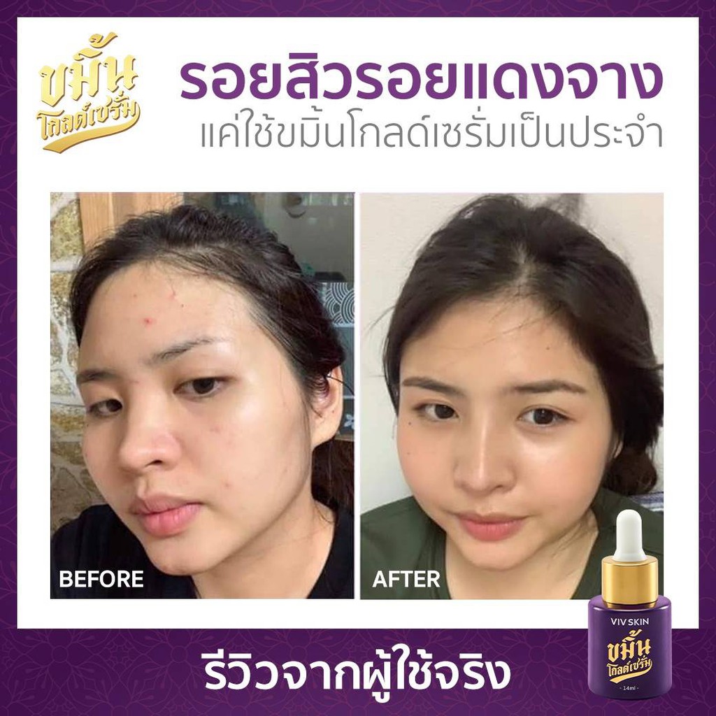 ขมิ้นโกลด์เซรั่ม-เซรั่มจุ๋ย-by-viv-skin-ให้คุณ-มั่นหน้าสด-ด้วยหยดขมิ้นทอง