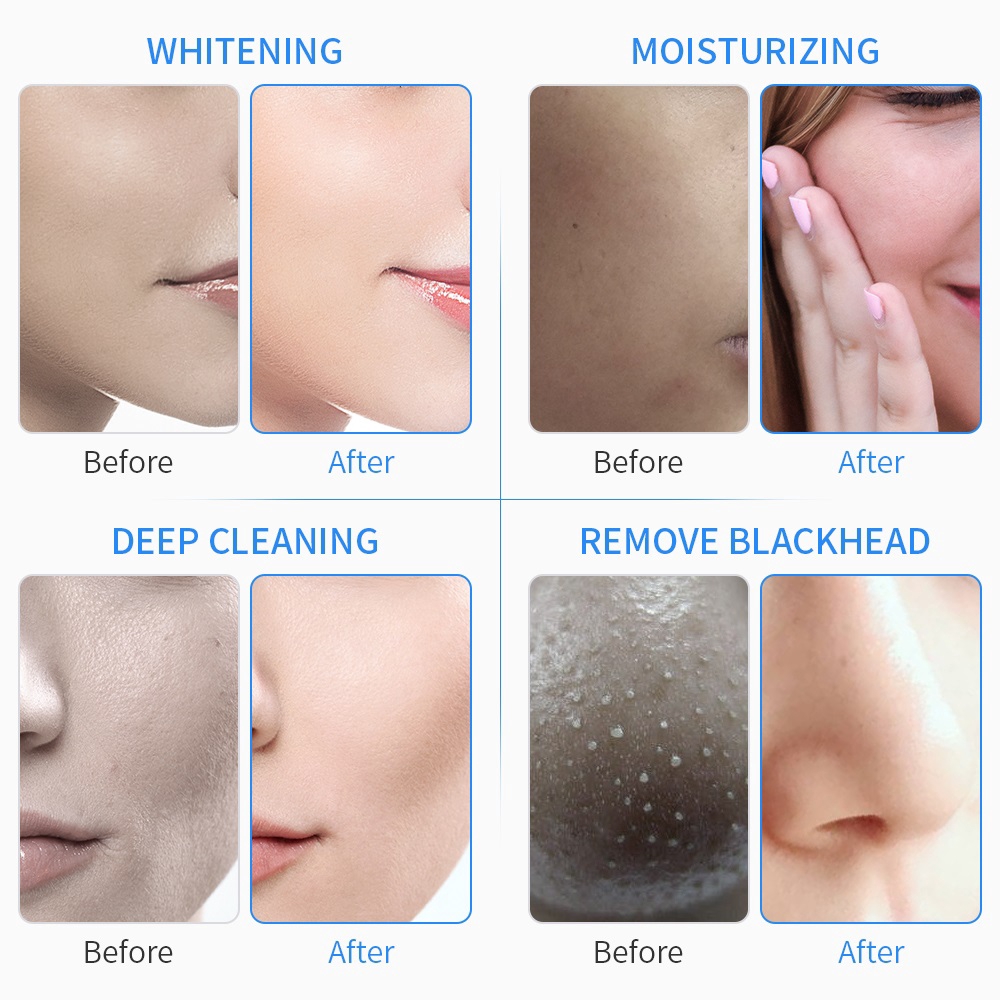 6-7-in-1-h2o-hydro-peel-microdermabrasion-hydra-blackhead-acne-facial-cleanser-beauty-salon-facial-hydrafacial-deep-clea