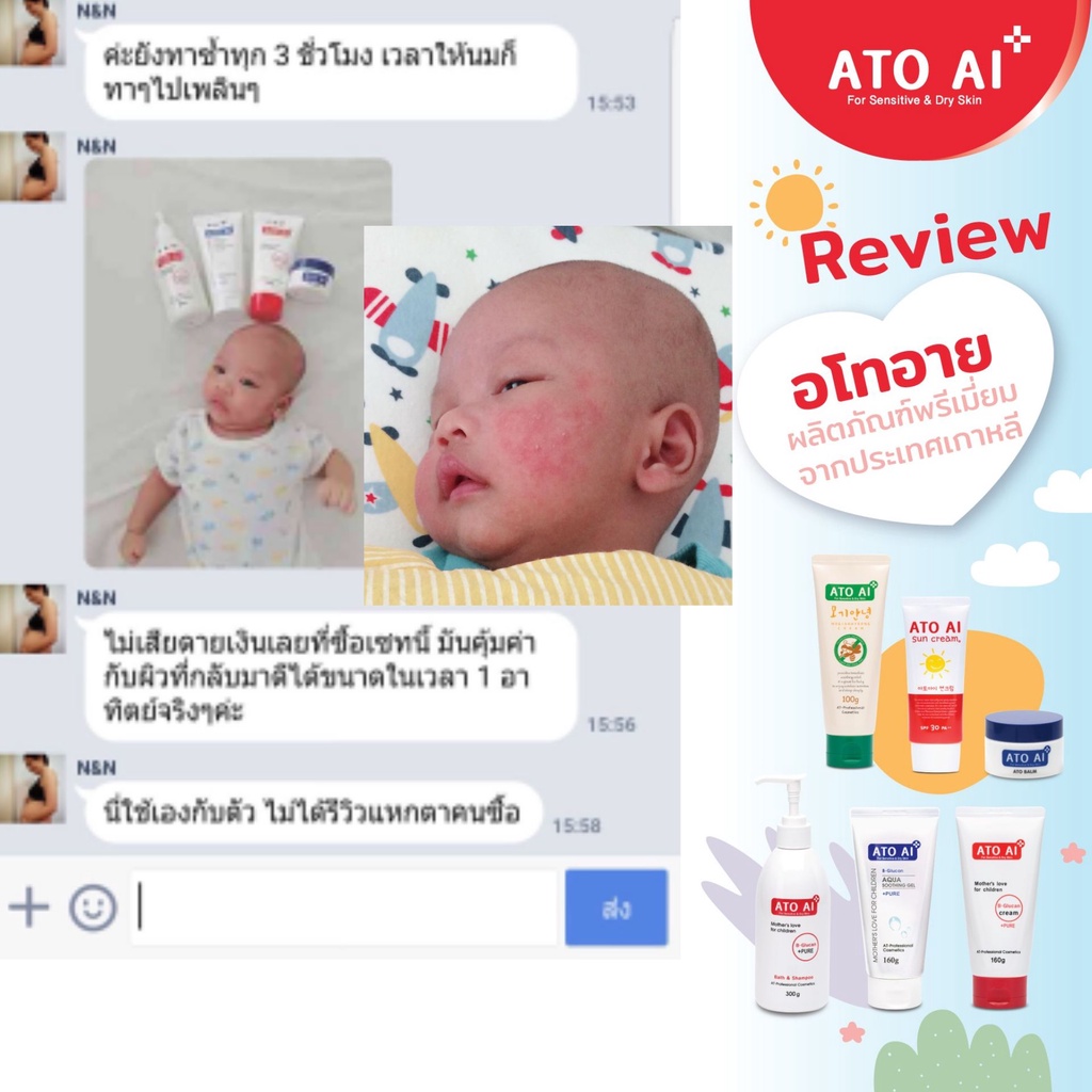 ครีมลดผดผื่น-ผิวแห้ง-ผิวแพ้-ครีมทาผิวเด็ก-อโทอายนำเข้าจากเกาหลี-ใช้ได้ตั้งแต่แรกเกิด-160-กรัม-นำเข้าจากเกาหลี