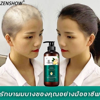 ZENSHOW 500ml แชมพูขิง แชมพูแก้ผมร่วง ยาสระผมแก้ผมร่วงสูตรแก้ปัญหาผมร่วง ปลูกผม เร่งผมเกิดใหม่