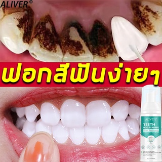 ALIVER มูสแปรงฟันขาว 60ml แก้ปัญหาหินปูน เคลือบฟัน ได้อย่างมีประสิทธิภาพ ยาสีฟันฟอกสีฟัน ยาสีฟันไวท์เทนนิ่ง