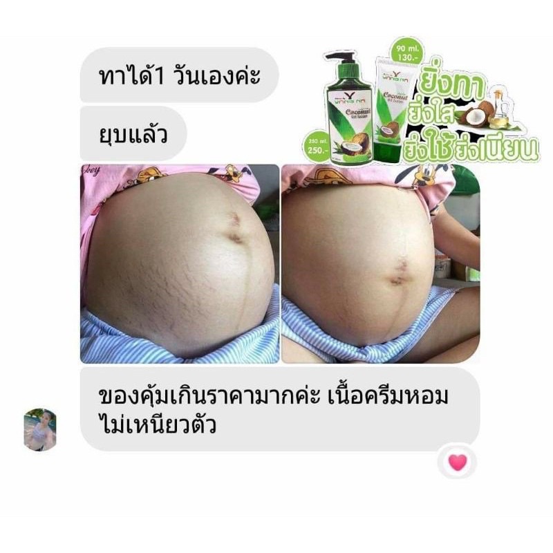 โลชั่นยางนา-โลชั่นน้ำมันมะพร้าว-สบู่มูสตำลึง