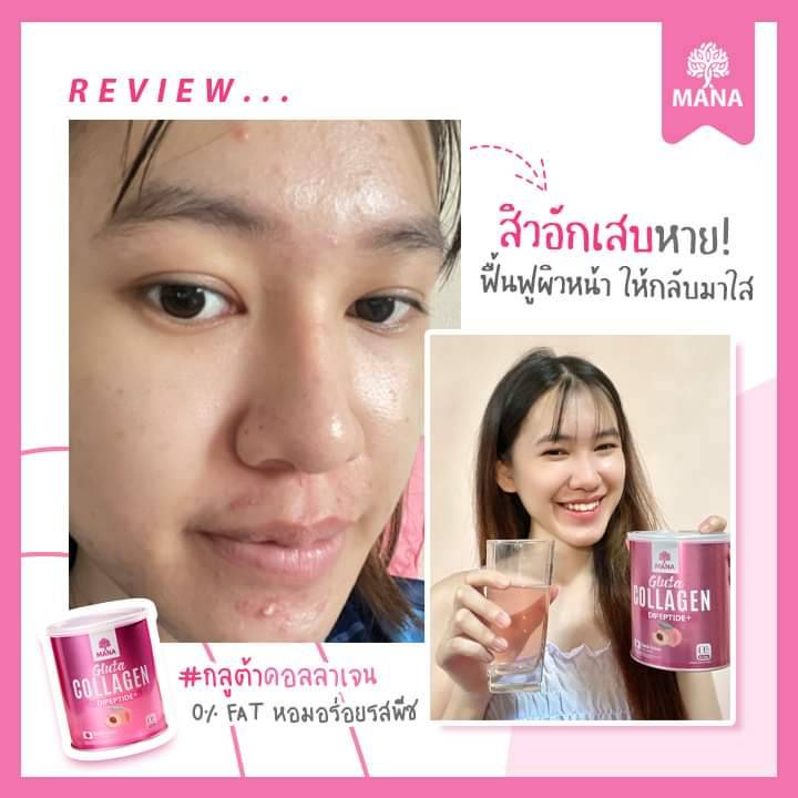 ซื้อ2-แถม-4-แท้-ส่งฟรี-mana-gluta-collagen-peach-มานา-กลูต้า-คอลลาเจนพีช-mana-กระปุกชมพู-แบบชง-รสพีช-มานาคอลลาเจน