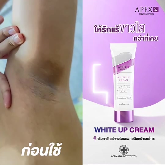 APEX-SX WHITE UP CREAM ครีมทารักแร้ขาว โดยแพทย์ผิวหนังเอเพ็กซ์ ทาขาหนีบดำ แก้มก้นดำ 50 ml.