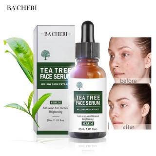 Tea Tree Intense Serum 30 ml เซรั่ม เข้มข้น สูตรช่วยลดสิวและควบคุมความมัน เผยผิวกระจ่างใส