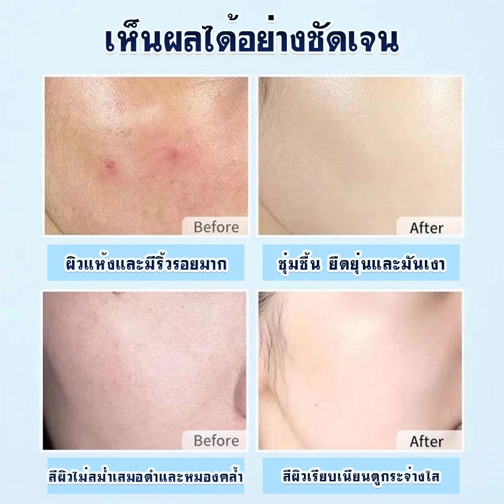 มาส์กหน้า-6-สูตรจากธรรมชาติ-สูตรผลไม้-ไฮยารูรอน-แผ่นมาส์กหน้านำเข้าจากเกาหลี