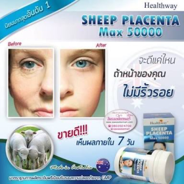 รกแกะ-healthway-sheep-placenta-max50000mg-รกแกะผิวเด็ก-100-เม็ด