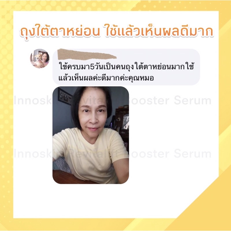 สูตรหมอ-เซรั่มโบท็อกซ์กระชับผิวเร่งด่วนในขวดแรก