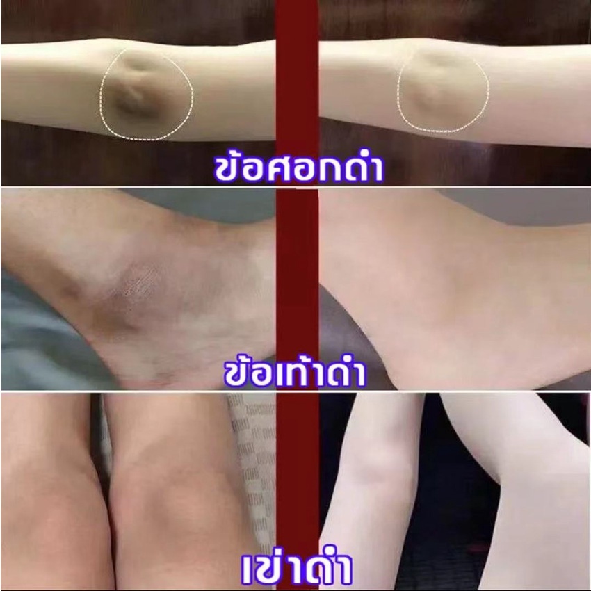 aichun-สบู่ผิวขาว-วิ้งไวท์-สบู่ขาว-สบู่สูตรเฉพาะ-สบู่ผิวขาวถาวร-สบู่สูตรลับเฉพาะ-สบู่ผิวขาวไว-สบู่แองเจิ้ล-สบู่ขัดผิวขาว