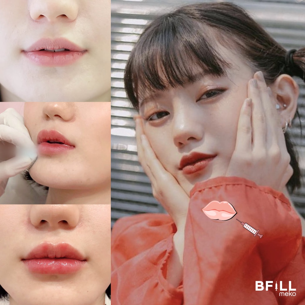 ภาพหน้าปกสินค้าFiller Sweden, Korea ฟิลเลอร์ สวีเดน เกาหลี ของแท้จากบริษัทโดยตรง จากร้าน mekobfillclinic บน Shopee