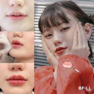 ภาพขนาดย่อของภาพหน้าปกสินค้าFiller Sweden, Korea ฟิลเลอร์ สวีเดน เกาหลี ของแท้จากบริษัทโดยตรง จากร้าน mekobfillclinic บน Shopee ภาพที่ 1