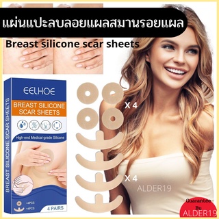 เทปแปะแผล เทปแปะหน้าอก สมานแผล เสริมหน้าอก Breast silicone scar sheets แผ่นแปะนม พลาสเตอร์แปะแผล ศัลยกรรม ลบลอยแผล