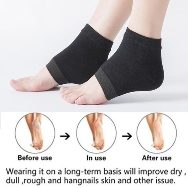 ถุงเท้าซิลิโคนเจลให้ความชุ่มชื้นส้นเท้า-2-ชิ้น